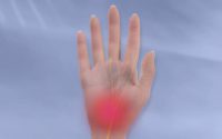 Carpal Tunnel Syndrome, Gejala dan Pengobatan